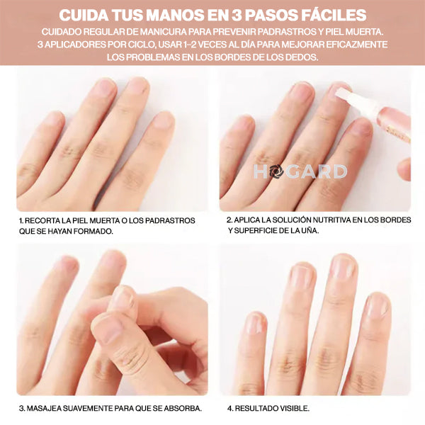 CuticleFix® – El secreto coreano para uñas fuertes y sin padrastros Paga 1 Lleva 2