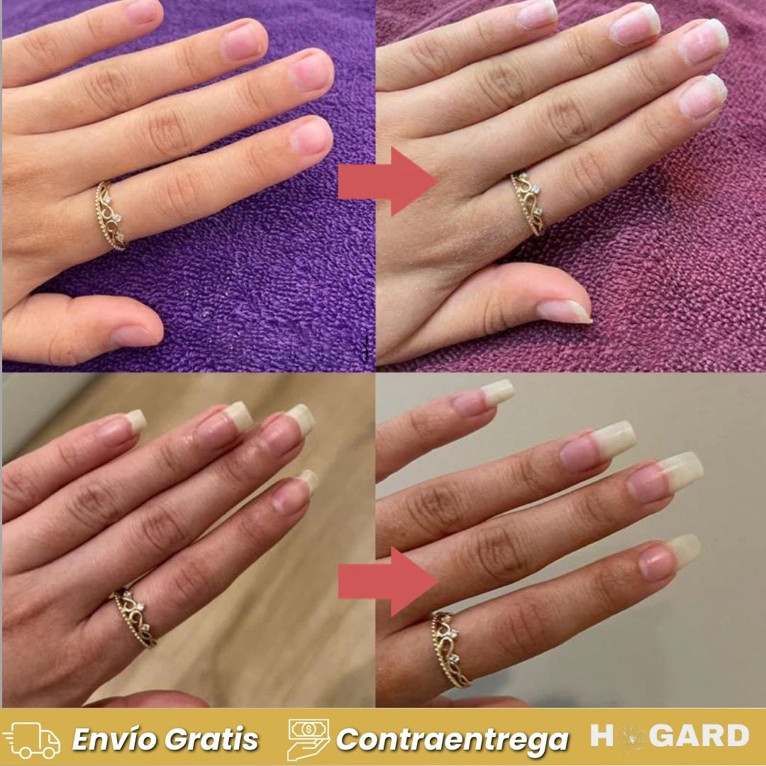 CuticleFix® – El secreto coreano para uñas fuertes y sin padrastros Paga 1 Lleva 2